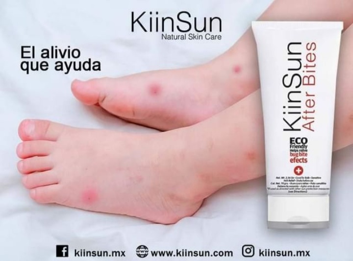 After Bites Natural 70 ml.